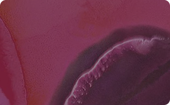 Clinical Evidence Summary- Vaginal health & combination of probiotic lactobacilli: ASTARTE™ & LA-5®